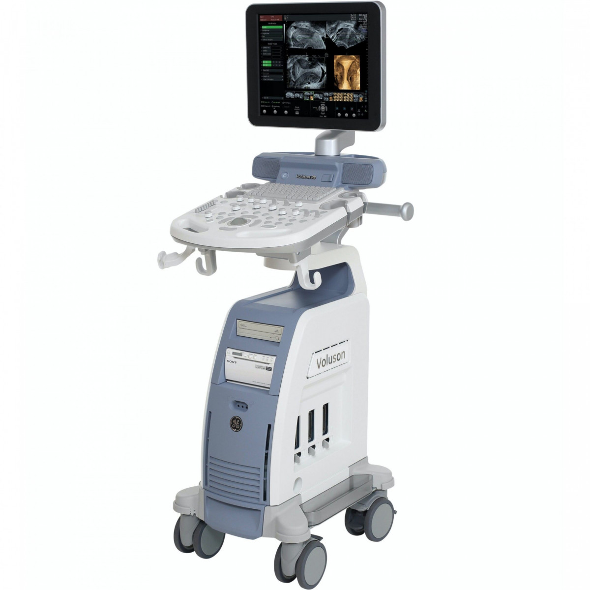 УЗИ аппарат GE Healthcare Voluson P8 УЗИ аппарат GE Healthcare Voluson P8