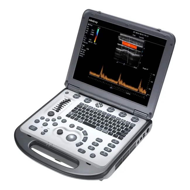 УЗИ аппарат Mindray M6